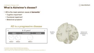 Alzheimers Disease – Diagnosis and Definitions – slide 6